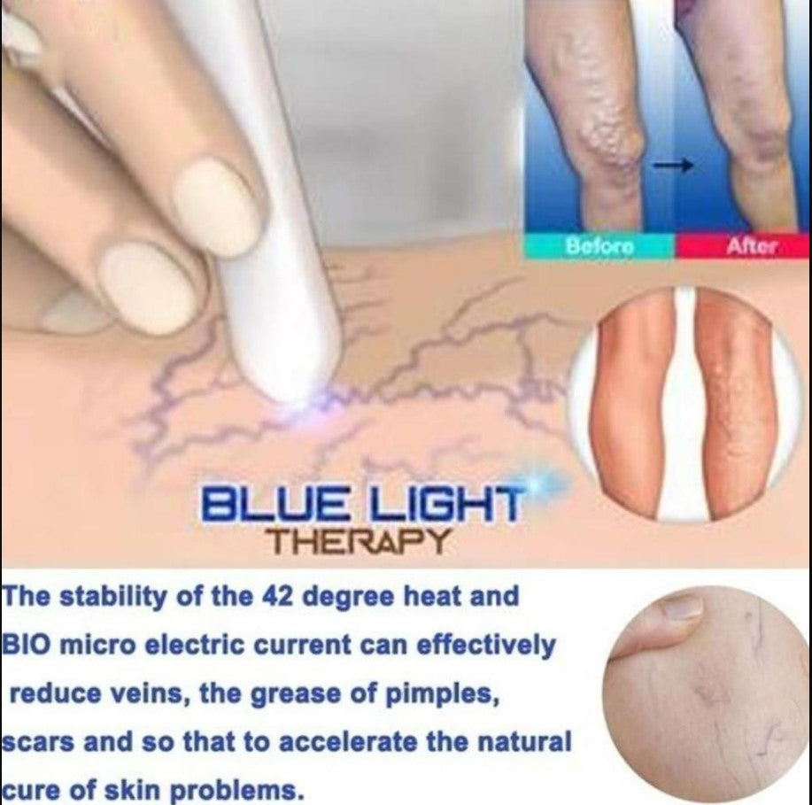 Blue & Red Light Therapy Machine – Skin Rejuvenation & Acne Treatment