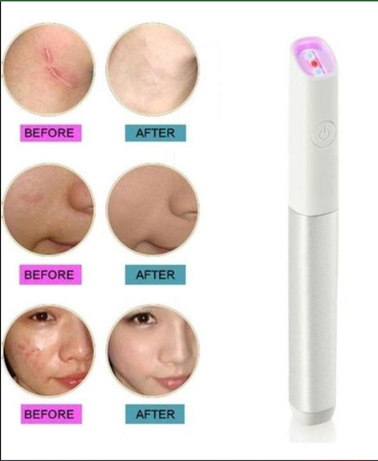 Blue & Red Light Therapy Machine – Skin Rejuvenation & Acne Treatment